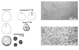  Seed, cotyledon, embryo, and testa:  A. cynometroides  D. Oliver - left seeds and testa SEMs;  A. microphyllus  (H.A.T. Harms) J.J. Wieringa - right seeds.
