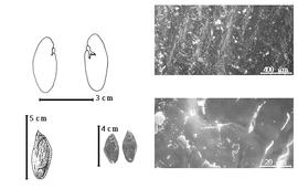  Seed, cotyledon, embryo, and testa:  A. psilophylla  (H.A.T. Harms) R.S. Cowan - top left cotyledon auriculate over radicle (L) and embryonic axis (R), bottom far left seed topography, bottom left center seeds, testa SEMs.
