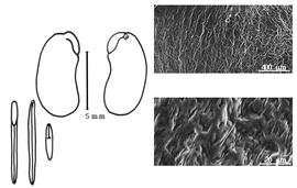  Cotyledon, embryo, and testa:  A. pseudo-malaccensis  E. Vieillard ex A.T. Brongnairt & J.A.A. Gris - embryo, cotyledons, and testa SEMs.
