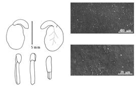  Cotyledon, embryo, and testa:  B. madagascariensis  (A.N. Desvaux) J.H. Kirkbride & J.H. Wiersema - embryo, cotyledons, and testa SEMs.
