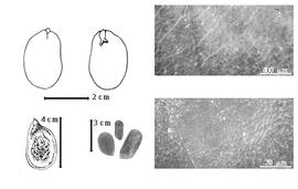  Seed, cotyledon, embryo, and testa:  B. massaiensis  (Taubert) H.A.T. Harms - top left cotyledon cordate investing nearly exposed radicle (L) and embryonic axis (R), testa SEMs;  B. occidentalis  Hutchinson - bottom far left seed topography;  B.  spp. - bottom left center seeds.
