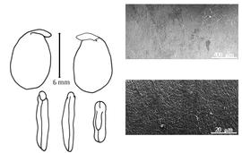  Cotyledon, embryo, and testa:  C. purpurea  (G. Piccioli) W. Aiton - embryo, cotyledons, and testa SEMs.
