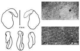  Cotyledon, embryo, and testa:  C. wolgarica  (C. Linnaeus f.) F.E.L. von Fischer ex A.P. de Candolle - embryo, cotyledons, and testa SEMs.
