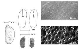  Seed, cotyledon, embryo, and testa:  C. dinklagei  H.A.T. Harms - top center cotyledon concealing radicle (L) and embryonic axis (R), bottom left seed topography, bottom center seeds, testa SEMs.
