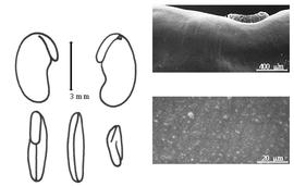  Cotyledon, embryo, and testa:  C. macrocarpa  (A.A. von Bunge) A. Rehder - embryo, cotyledons, and testa SEMs.
