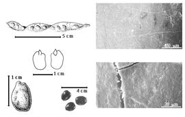  Seed, cotyledon, embryo, and testa:  C. oreothauma  Hillcoat, Lewis & Verdcourt - left top fruit;  C. siliqua  C. Linnaeus - left center cotyledon auriculate over margin of radicle (L) and embryonic axis (R), bottom far left seed topography, bottom left center seeds, testa SEMs.
