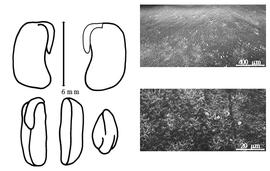  Cotyledon, embryo, and testa:  C. andravinensis  H.E. Baillon - embryo, cotyledons, and testa SEMs.
