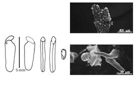  Cotyledon, embryo, and testa:  C. brasiliensis  (J.R.T. Vogel) G. Bentham - embryo and cotyledons;  C. latisiliqua  (J.L.M. Poiret) G. Bentham ex W.B. Hemsley - testa SEMs.
