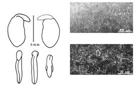  Cotyledon, embryo, and testa:  C. lutea  (F.A. Michaux) K.H.E.L. Koch - embryo, cotyledons, and testa SEMs.
