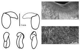  Cotyledon, embryo, and testa:  C. puniceus  (G. Don) D.C. Solander ex J. Lindley - embryo, cotyledons, and testa SEMs.
