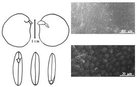  Cotyledon, embryo, and testa:  C. fairchildiana  R.A. Howard - embryo, cotyledons, and testa SEMs.
