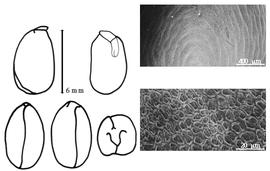  Cotyledon, embryo, and testa:  C. speciosa  (J.L.A. Loiseleur-Deslongchamps) A.P. de Candolle - embryo, cotyledons, and testa SEMs.
