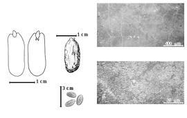  Seed, cotyledon, embryo, and testa:  C. racemosa  W. Bojer - far left cotyledon cordate and investing exposed radicle (L) and embryonic axis (R), top left center seed topography, bottom left center seeds, testa SEMs.
