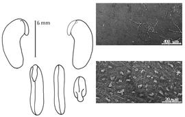  Cotyledon, embryo, and testa:  C. matthewsii  (G. Bentham) R.W. Schery - embryo, cotyledons, and testa SEMs.
