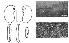  Cotyledon, embryo, and testa:  D. nyasae  E.G. Baker - embryo, cotyledons, and testa SEMs.
