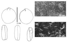  Cotyledon, embryo, and testa:  D. bracteata  (W. Roxburgh) R.C. Graham ex G. Bentham - embryo, cotyledons, and testa SEMs.
