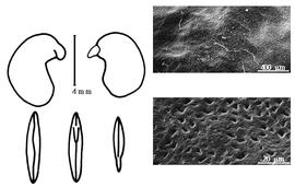  Cotyledon, embryo, and testa:  D. psoraleifolium  G. Bentham - embryo, cotyledons, and testa SEMs.
