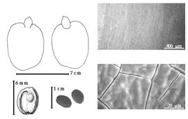  Seed, cotyledon, embryo, and testa:  D. benthamianus  H.E. Baillon - top left cotyledon investing exposed radicle (L) and embryonic axis (R), bottom far left seed topography, bottom left center seeds, testa SEMs.
