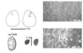  Seed, cotyledon, embryo, and testa:  E. bicolor  W.A. Ducke - testa SEMs;  E. coccinea  R.H. Schomburgk ex G. Bentham - bottom far left seed topography, top left cotyledon notched and split and concealing radicle (L) and embryonic axis (R), bottom left center seeds.
