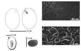  Seed, cotyledon, embryo, and testa:  E. spectabilis  C.G.G.J. van Steenis & H.C.D. de Wit - top left cotyledon notched and split (L) and embryonic axis (R), bottom far left seed topography, bottom left center seed, testa SEMs.
