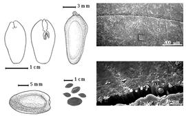  Seed, cotyledon, embryo, and testa:  E. contortisiliquum  (Vellozo) Morong - top left center seed topography;  E. cyclocarpum  (N.J. von Jacquin) A.H.R. Grisebach - bottom left seed topography, top left cotyledons concealing radicle (L) and embryonic axis (R), testa SEMs;  E.  spp. - bottom left center seeds.
