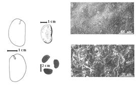  Seed, cotyledon, embryo, and testa:  E. batesii  E.G. Baker - far left cotyledon split and concealing radicle (above) and embryonic axis (below), top left center seed topography, bottom left center seeds, testa SEMs.
