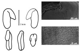  Cotyledon, embryo, and testa:  E. microphylla  (R. Brown) J.M. Black - embryo, cotyledons, and testa SEMs.
