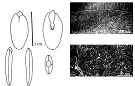  Cotyledon, embryo, and testa:  F. moluccana  (F.A.W. Miquel) R.C. Barneby & J.W. Grimes - embryo, cotyledons, and testa SEMs.
