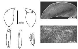  Cotyledon, embryo, and testa:  F. gracilis  H.A.T. Harms - embryo, cotyledons, and testa SEMs.
