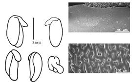  Cotyledon, embryo, and testa:  G. bilobum  R. Brown - embryo, cotyledons, and testa SEMs.
