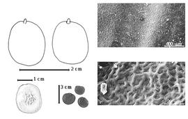  Seed, cotyledon, embryo, and testa:  G. simplicifolia  (M.H. Vahlndolle) H.E. Baillon - top left cotyledon cordate and not concealing radicle (L) and embryonic axis (R), bottom far left seed topography, testa SEMs;  G.  spp. - bottom left center seeds.
