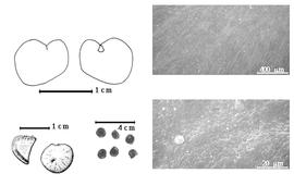  Seed, cotyledon, embryo, and testa:  H. gabunense  P.H.W. Taubert - top left cotyledon split and concealing radicle (L) and embryonic axis (R), bottom far left seed topographies (seed from multiseeded fruit (L) and seed from 1-seeded fruit (R), bottom left center seeds, testa SEMs.
