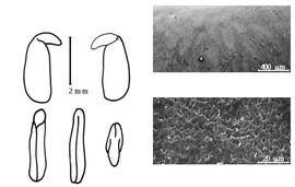  Cotyledon, embryo, and testa:  H. sophoroides  (P.J. Bergius) H.E. Baillon - embryo, cotyledons, and testa SEMs.
