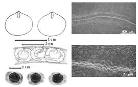  Seed, cotyledon, embryo, and testa:  I. oudhensis  (Brandis) J.P.M. Brenan - top left cotyledon not concealing radicle (L) and embryonic axis (R), center left seed in situ, bottom left seeds, and testa SEMs.
