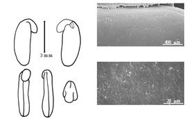  Cotyledon, embryo, and testa:  K. macrophylla  (C.F.W. Meissner) G. Bentham - embryo, cotyledons, and testa SEMs.
