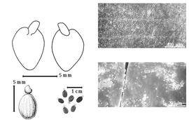  Seed, cotyledon, embryo, and testa:  L. lanceolata  G. Bentham - top left cotyledon cordate and investing exposed radicle (L) and embryonic axis (R), bottom far left seed topography, bottom left center seeds, testa SEMs.
