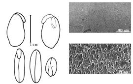  Cotyledon, embryo, and testa:  L. purpureus  (C. Linnaeus) R. Sweet - embryo, cotyledons, and testa SEMs.
