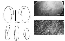  Cotyledon, embryo, and testa:  L. virginica  (C. Linnaeus) N.L. Britton - embryo, cotyledons, and testa SEMs.
