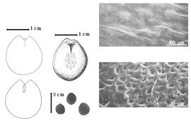  Seed, cotyledon, embryo, and testa:  L. klainei  (J.B.L. Pierre ex H.A.T. Harms) A.C. Hoyle - far left cotyledon notched and split and concealing radicle (radiclelike structure is a plug of endosperm) (above) and embryonic axis (below), top left center seed topography, bottom left center seeds, testa SEMs.
