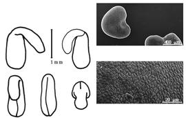  Cotyledon, embryo, and testa:  L. bainesii  J.G. Baker - embryo, cotyledons, and testa SEMs.
