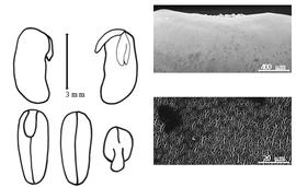  Cotyledon, embryo, and testa:  M. lathyroides  (C. Linnaeus) I. Urban - embryo, cotyledons, and testa SEMs.
