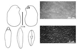  Cotyledon, embryo, and testa:  M. buteiformis  J.O. Voigt - embryo, cotyledons, and testa SEMs.
