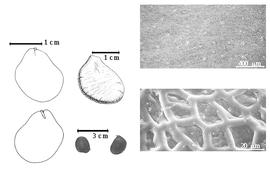  Seed, cotyledon, embryo, and testa:  M. brazzavillensis  A.J.B. Chevalier - far left cotyledon split and concealing all but tip of radicle (above) and embryonic axis (below), top left center seed topography, bottom left center seeds, testa SEMs.
