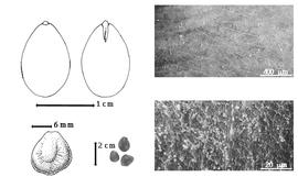  Seed, cotyledon, embryo, and testa:  M. spicata  (Dalzell) Nicolson - top left cotyledon entire and concealing all but tip of radicle (L) and embryonic axis (R), bottom far left seed topography, bottom left center seeds, testa SEMs.
