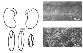  Cotyledon, embryo, and testa:  M. sericea  (C.L. von Willdenow) A.J.B. Chevalier - embryo, cotyledons, and testa SEMs.
