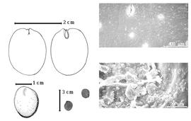  Seed, cotyledon, embryo, and testa:  O. micrantha  (H.A.T. Harms) E.G. Baker - bottom left center seeds;  O.  spp. - bottom far left seed topography, top left cotyledon split and undulate auriculate and concealing radicle (L) and embryonic axis (R), testa SEMs.
