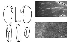  Cotyledon, embryo, and testa:  O. radicosa  (A. Richard) B. Verdcourt - embryo, cotyledons, and testa SEMs.
