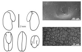  Cotyledon, embryo, and testa:  O. hirtum  (C. Linnaeus) C.H. Stirton - embryo, cotyledons, and testa SEMs.
