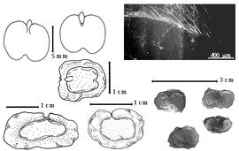  Seed, cotyledon, embryo, and testa:  P. blanchetii  (G. Bentham) J.P.M. Brenan - bottom left seed topography;  P. pterosperma  (G. Bentham) J.P.M. Brenan - bottom center seed topography;  P. rigida  (G. Bentham) J.P.M. Brenan - top left cotyledons not concealing radicle (L) and embryonic axis (R), left center seed topography, testa SEM, bottom right seeds.
