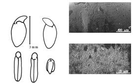  Cotyledon, embryo, and testa:  P. filifolia  J. Torrey & A. Gray - embryo, cotyledons, and testa SEMs.
